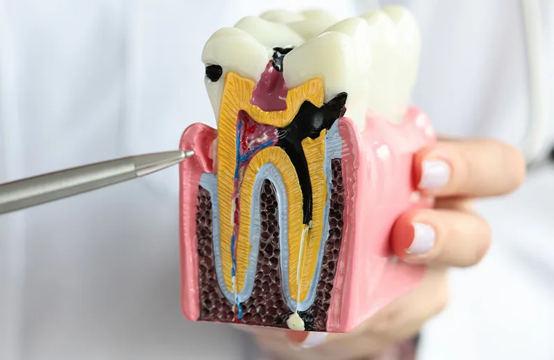 endodoncia en sant feliu