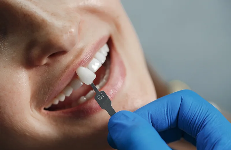 estetica dental